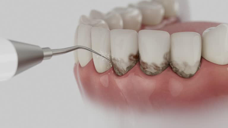 Reliable Emergency Dentist contractor in Cave Spring, VA by Smile Center Dentistry